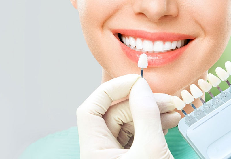 clareamento-dental-odontocosta