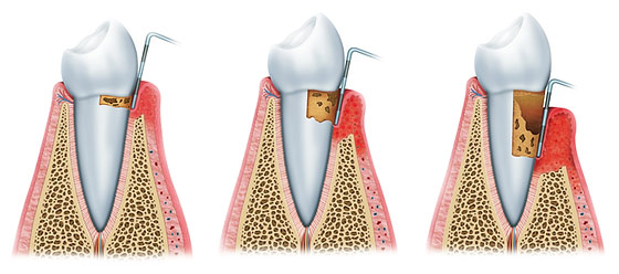 periodontia-odontocosta-pag-3