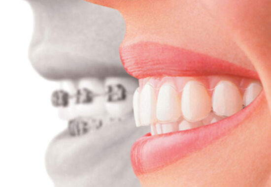 ortodontia-odontocosta2